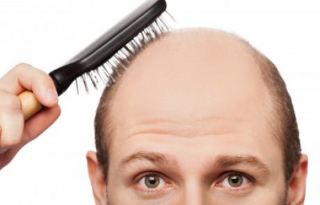 מדריך השתלת שיער לגברים